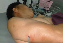 Warga Purirano Jadi Korban Pembusuran Orang Tak Dikenal