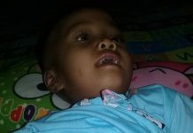 Risma, Bocah Asal Kabaena Butuh Bantuan untuk Operasi Tumor