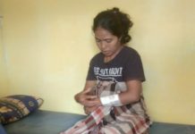Warga Mubar Digigit Buaya saat Mencuci di Sungai Tiworo