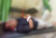 Satu Warga Tewas Tertimpa Pohon Tumbang di Depan Kantor Samsat Kendari